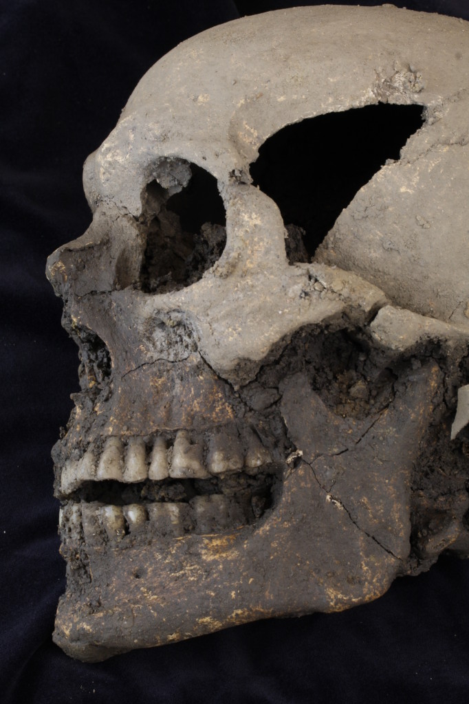 The skull of one of the individuals excavated at College Green (Copyright Rubicon Heritage Services Ltd)